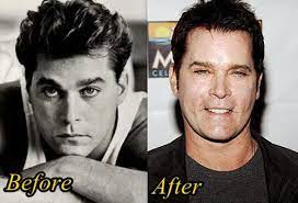 Many actresses and actors go under the surgeon's knife to maintain their youthful looks. Ray Liotta Plastic Surgery Gone Wrong Before And After Plastic Surgery Ray Liotta Bad Plastic Surgeries