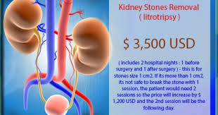 Best Kidney Stones Removal Package In Mexicali Mexico Kidney Stones Treat Kidney Stones Gallbladder Stones