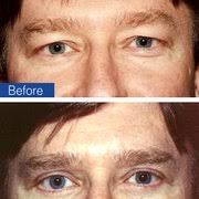 WEISS COSMETIC & LASER PROCEDURES