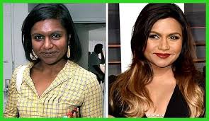 Image Result For Laser Skin Lightening Before And After Skinbleachingbeforeanda Laser Skin Lighten Skin Celebrity Skin
