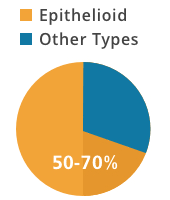 Content updated daily for how is mesothelioma treated. Epithelioid Mesothelioma Epithelial Cell Prognosis Treatment