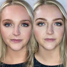 Litwin Cosmetic Solutions