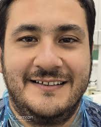 Dr.Kamran Mammadov added a new photo.