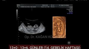 13 haftalik 3 aylik ultrasonda bebegin ense kalinligi burun kemigi ve organlari nasil gorunur youtube