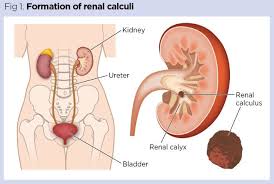 Effects Of Bedrest 4 Renal Reproductive And Immune Systems Nursing Times