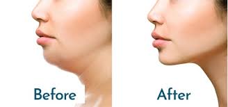 Dr. Megha Vyas January 2025