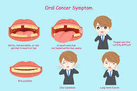 Oral cancer is hard to detect because it is typically a small painless white or red spot in the mouth so this is easily ignored. Oral Cancer Symptoms Causes Prevention Diagnose
