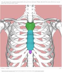 Image result for Point of Maximum Impulse