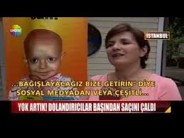 Losev Sac Bagisi Kabul Etmiyor Youtube