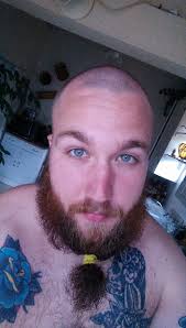 Why does the back of my neck start burning after an hour of riding a  motorcycle?