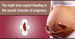 More than 60 % of pregnant women experience spotting during pregnancy. Problems During Second Trimester Healofy