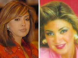نوال الزغبي بعد عملية التجميل 2020 وردت نوال الزغبي، على المظاهرات التي اقيمت في لبنان والتي جاءت نتيجة الوضع الاقتصادي وتدهور العملة وتدهور الحالة المعيشية مؤكدا من يستطيع لوم شعب فقير تأثر. Fay3 Ù†ÙˆØ§Ù„ Ø§Ù„Ø²ØºØ¨ÙŠ Ù‚Ø¨Ù„ ÙˆØ¨Ø¹Ø¯ Ø¹Ù…Ù„ÙŠØ§Øª Ø§Ù„ØªØ¬Ù…ÙŠÙ„