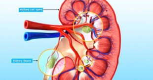 Kidney Stone 101 Why They Happen What To Do About Them Hellawella Kidney Stones Kidney Stones Remedy What Causes Kidney Stones