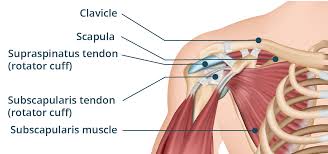 Image result for Rotator Cuff Rupture
