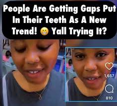 Gap filler and (mostly) virgin arm 😅