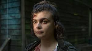 The scarred victim in Craith who's battling to live