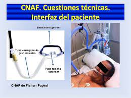 Despachos equipados listos para ocupar sin. Tratamiento Con Cnulas Nasales De Alto Flujo Cnaf