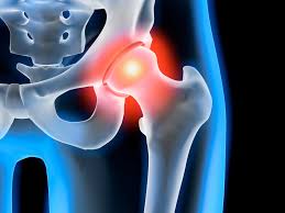Image result for Hip Injection