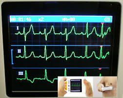 Bei einem ekg werden die elektrischen aktionen vom herz. Mobiles Hand Ekg Gerat 3 Kanal Notfall 24 Stunden Patienten Monitor Herzfrequenz Ebay