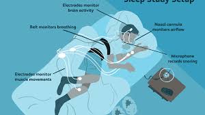 Overnight Sleep Study Uses Procedure Results