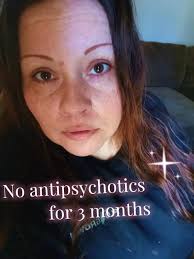 Do Antipsych Meds Change Your Face