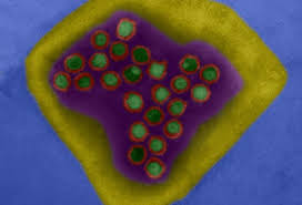 The herpes simplex viruses are both similar and different and are often misunderstood. Genital Herpes Pictures Symptoms Treatment And More