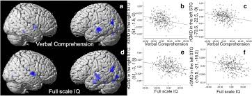 It's the ultimate brain game, guys. The Impact Of Parent Child Interaction On Brain Structures Cross Sectional And Longitudinal Analyses Journal Of Neuroscience