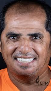 ✨Transforma tu sonrisa 😃 con ORTODONCIA ✨ En manos de un especialista el  Dr.Marvin Benavides ✓ Contamos con diferentes tipos de brackets ✓ Sin Prima  ✓ Cómodas cuotas ✓ Contamos con centro