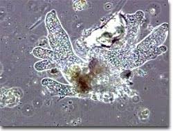 Check spelling or type a new query. Molecular Expressions Digital Video Gallery Pond Life Amoeba Protozoa