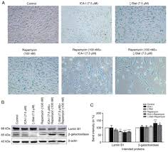 Choose below from our in stock selection of rubber wristbands, ribbon magnets, lapel pins and more or place a custom. Simultaneous Inhibition Of Atypical Protein Kinase C And Mtor Impedes Bladder Cancer Cell Progression