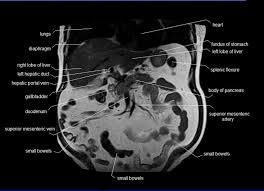 Anatomy Human Abdomen Mri Abdomen Coronal Anatomy Free Cross Sectional Anatomy Anatomy Mri Superior Mesenteric Artery