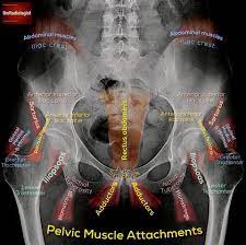 This mri male pelvis axial cross sectional anatomy tool is absolutely free to use. Pelvic X Ray Anatomy Ashiry Radiology Students Of A M S Facebook