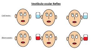 Image result for Oculovestibular Testing