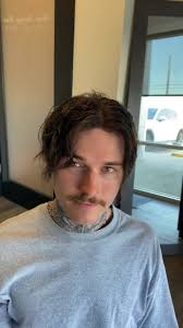 Achieving Hair Goals: Hair Replacement System Transformation