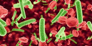 Image result for Sepsis