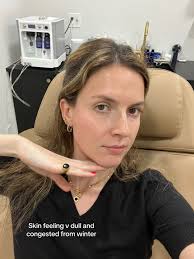 Facial Upper East Side New York