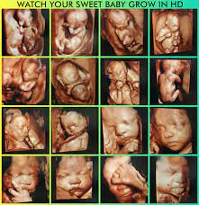 3d Ultrasound Ft Myers 4d Ultrasound Ft Myers Sweet Baby O Mine Ft Myers Florida