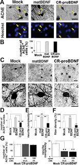 Facilitates hundreds of client nationally across all kind of industries. Multiple Functions Of Precursor Bdnf To Cns Neurons Negative Regulation Of Neurite Growth Spine Formation And Cell Survival Molecular Brain Full Text