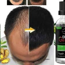 Petua tradisional yang kerap digunakan untuk perawatan rambut adalah dengan menggunakan santan. Petua Dan Tips Rambut Lebat Home Facebook