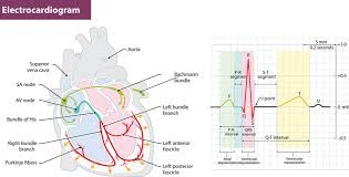 Electrocardiography in clinical practice, n. Electrocardiogram Ekg Or Ecg Eden Internal Medicine Eden Nc