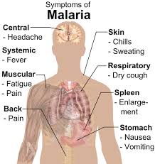 Image result for Malaria