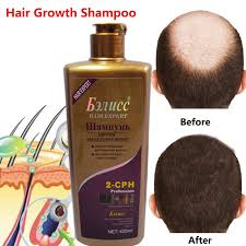 Ready within 2 hours with pickup. Hair Shampoo Anti Off Hair Growth Natural Herbal Extracts Hair Regrowth Fast Shampoo Professional Care 3 Types Free Shipping Hair Shampoo Fast Shampooprofessional Shampoo Aliexpress