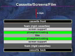 Radiology X Ray Film Screens