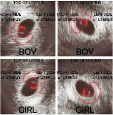 Healthcare providers can do this test toward the end of the first trimester, usually at about 10. Pin On Babies Kids