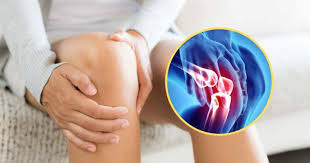 Sakit lutut boleh berlaku akibat tulang patah, kecederaan pada ligamen atau meniskus, terkehel merawat sakit lutut. Sakit Lutut Selepas Berlari Punca Kesakitan Dan Cara Merawat Terbaik