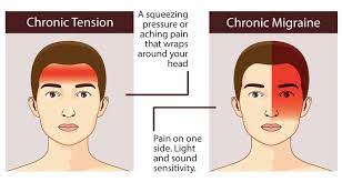 Like migraine headaches, doctors are unsure about the cause of cluster headaches. Headache Location Chart Does Headache Location Matter