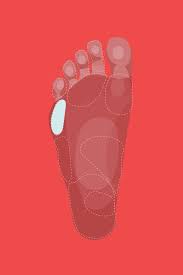 Cuboid syndrome causes lateral foot pain, often after an ankle sprain. Why Do My Feet Hurt Foot Pain Relief Causes