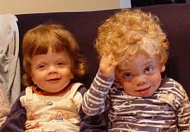 Hurler Syndrome Mps I The Oncofertility Consortium