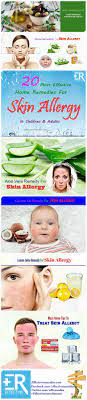 20 Most Effective Home Remedies For Skin Allergy In Children Adults Home Remedies For Skin Skin Allergy Allergies