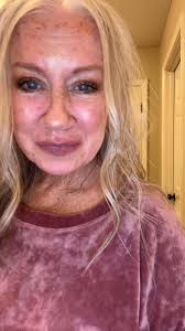 Yes my legs are little! I lost all my muscle with all of my surgeries! I’m  release to get back in the gym so don’t come for me! My muscle will be  back! 😂😂 My over 50 outfit of the day🩷🥰 #ootd #cutesy ...